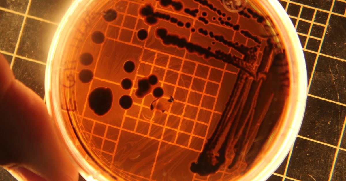 Bakteriekolonier i en petriskal under lys – Probiotisk hudpleje og postbiotika – Trondahl Skincare