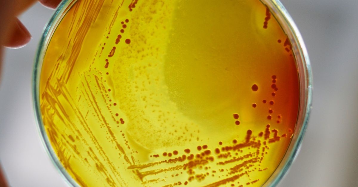 Petriskal med mikroorganismer i laboratoriet – Galactomyces i hudpleje – Trondahl Skincare