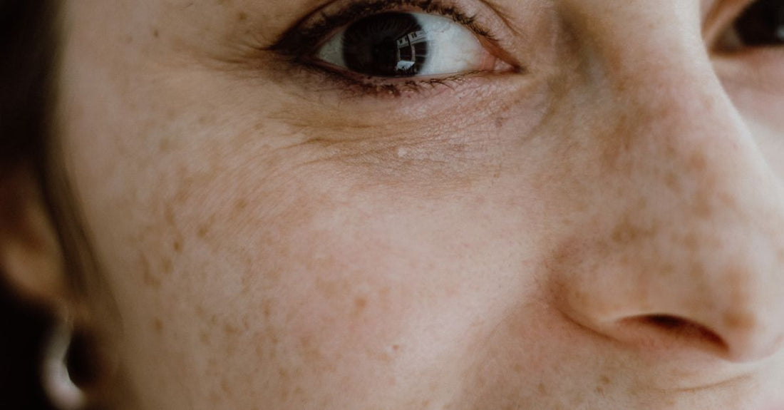 Kvinde med naturlig hud closeup – kollagen og hud guide – Trondahl Skincare