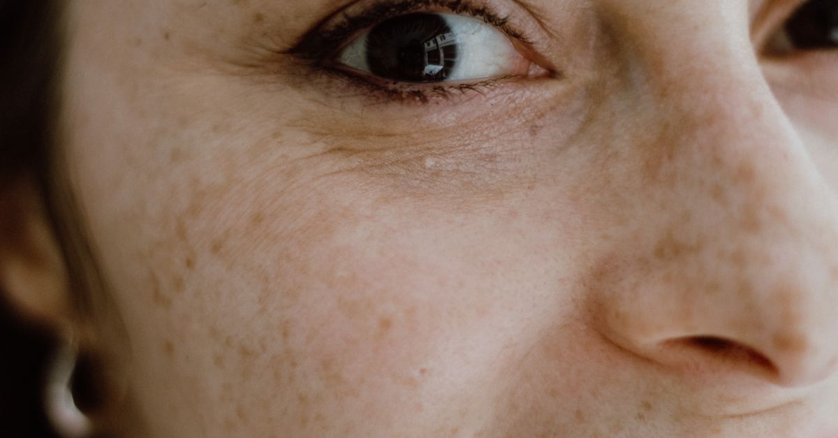Kvinde med naturlig hud closeup – kollagen og hud guide – Trondahl Skincare