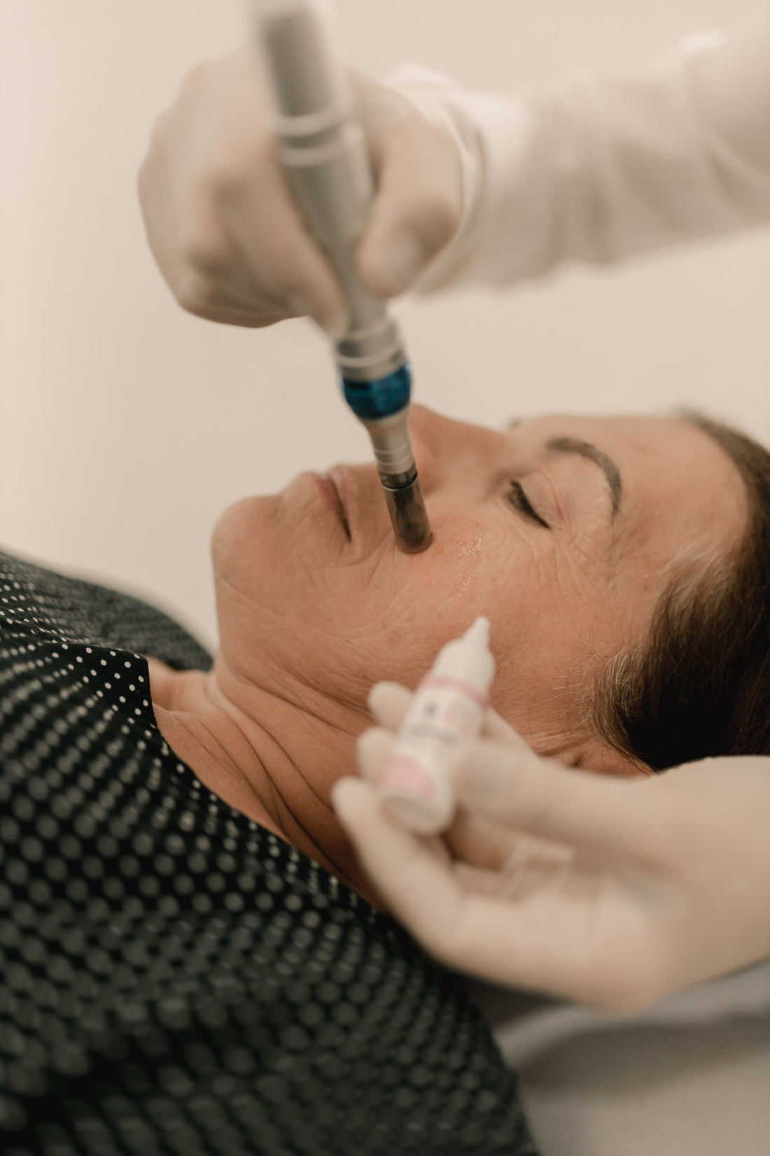 Hudbehandling tæt på – guldbelagte nåle og metalallergi – Trondahl Skincare