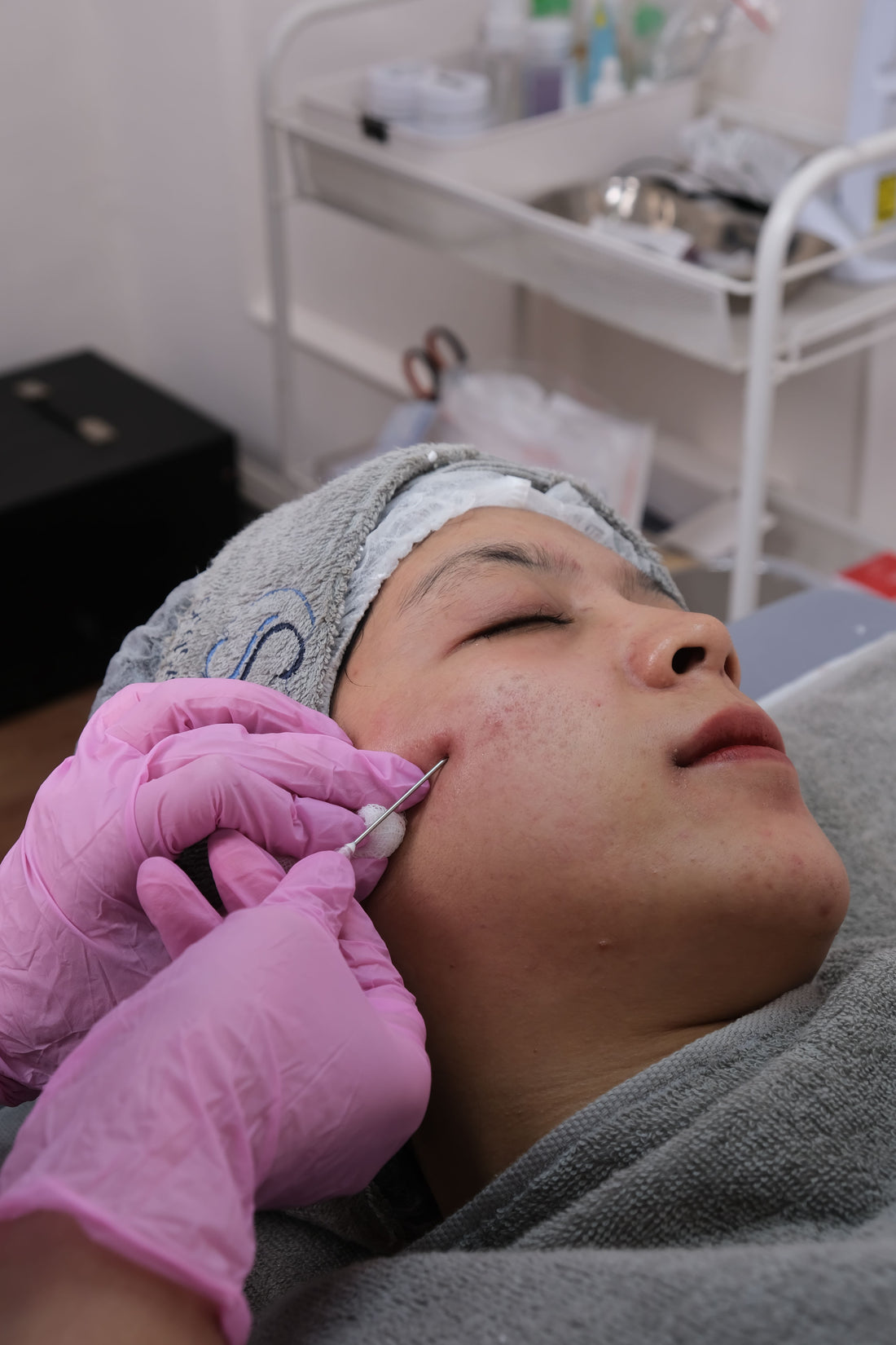 Microneedling-behandling – hals og décolleté – Trondahl Skincare