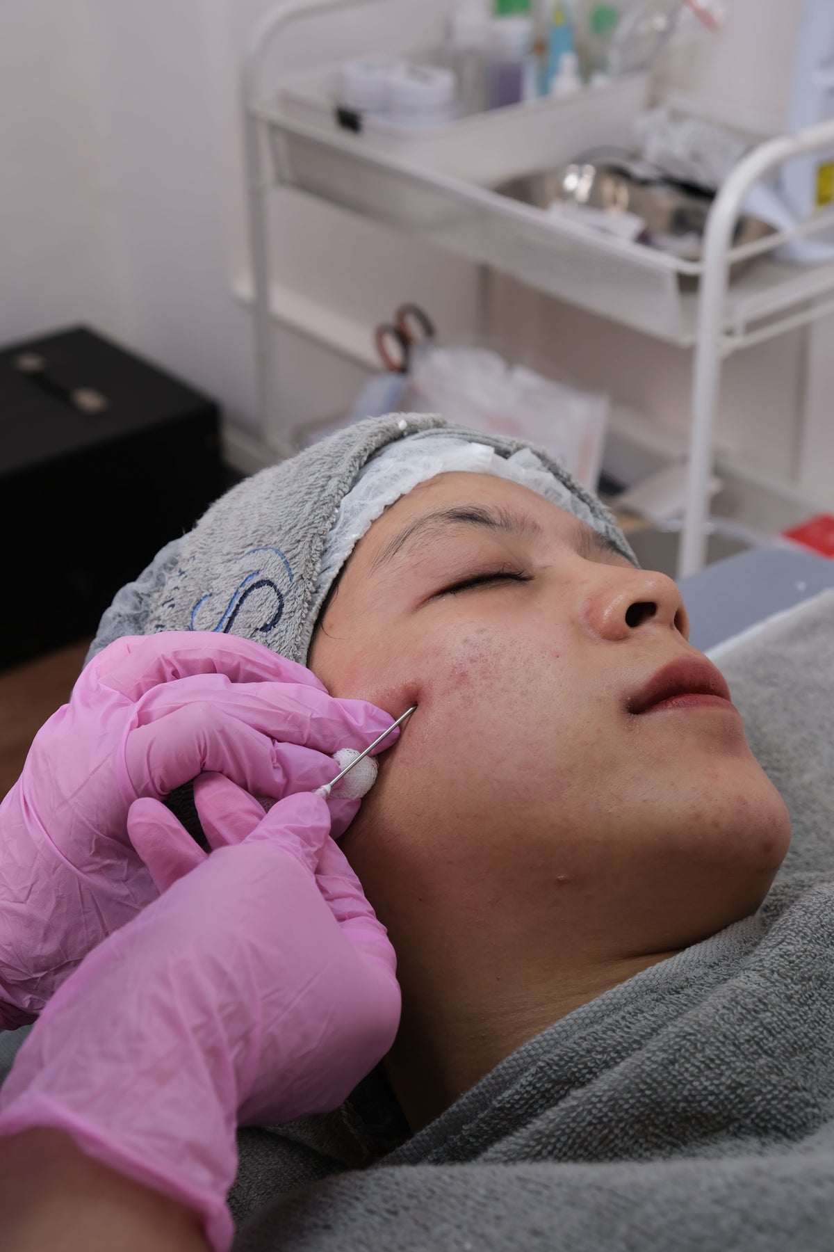 Microneedling-behandling – hals og décolleté – Trondahl Skincare