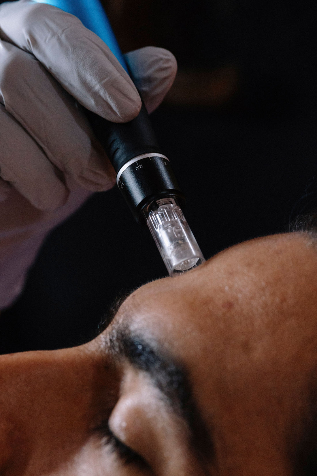 Micro infusion-pen tæt på – hvad er micro infusion – Trondahl Skincare