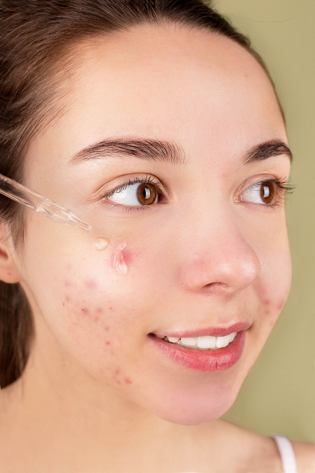 Kvinde påfører serum i ansigtspleje – panderynker behandling – Trondahl Skincare